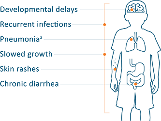 Graphic showing signs of ADA-SCID